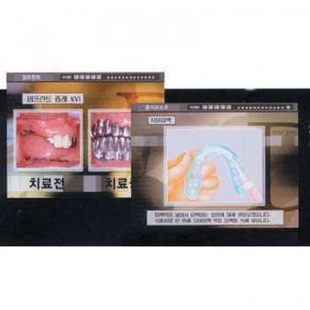 인포비젼 (LCD형,본체포함형)